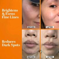 TruSkin Vitamin C Face Serum – Anti-Aging & Brightening Formula - Image 5